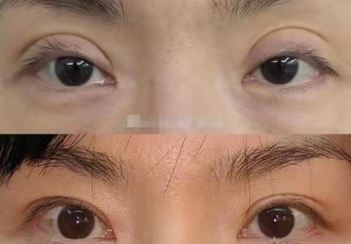 南京做双眼皮修复最好的医生预约排行榜