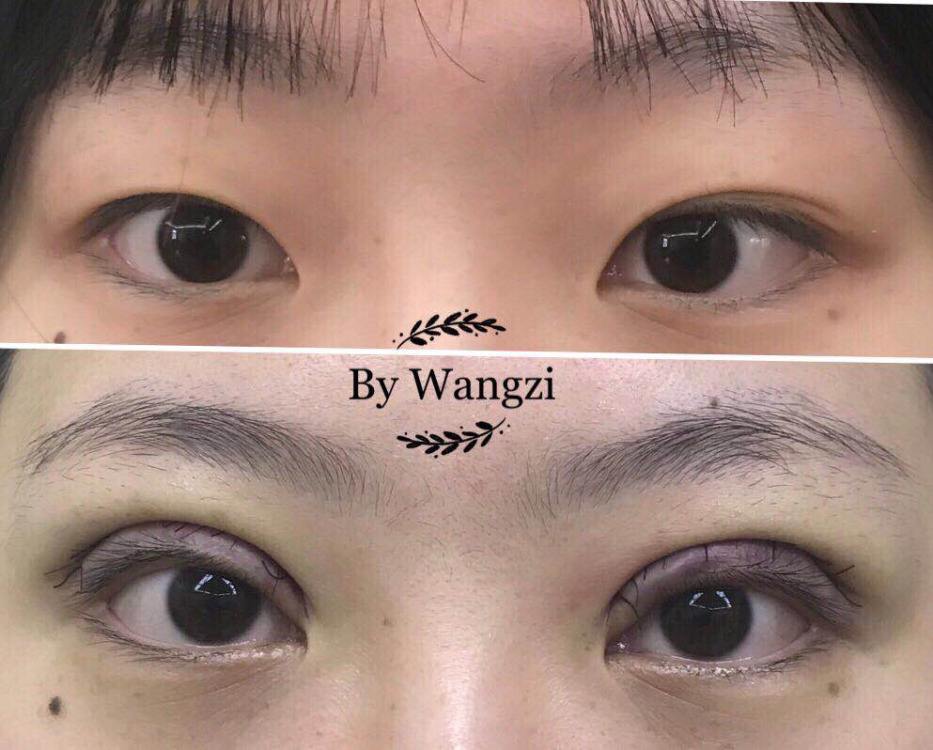 上海九院双眼皮修复专家是谁？